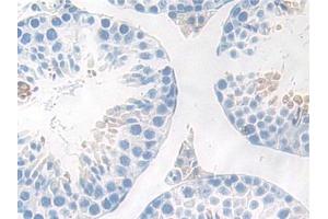 DAB staining on IHC-P; Samples: Mouse Testis Tissue (IKbIP Antikörper  (AA 78-301))