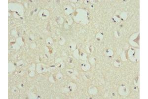 Immunohistochemistry of paraffin-embedded human brain tissue using ABIN7159178 at dilution of 1:100 (MATK Antikörper  (AA 393-507))