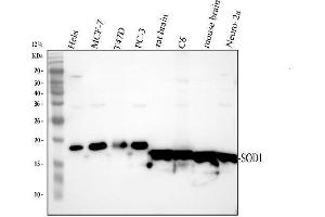 Western blot analysis of SOD1 using anti-SOD1 antibody (ABIN3043438).