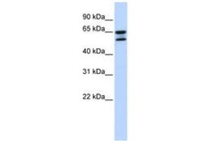 Image no. 1 for anti-Acyl-CoA Thioesterase 11 (ACOT11) (AA 504-553) antibody (ABIN6743818)
