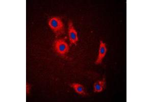 Immunofluorescent analysis of NCKX1 staining in HeLa cells. (SLC24A1 Antikörper  (Center))