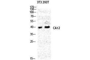 Western Blotting (WB) image for anti-Carbonic Anhydrase 12 (CA12) (Internal Region) antibody (ABIN3180517) (CA12 Antikörper  (Internal Region))