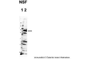 Sample Type: 1. (NSF Antikörper  (C-Term))