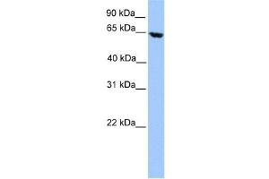 Western Blotting (WB) image for anti-Acyl-CoA Dehydrogenase, Very Long Chain (ACADVL) antibody (ABIN2459763) (ACADVL Antikörper)