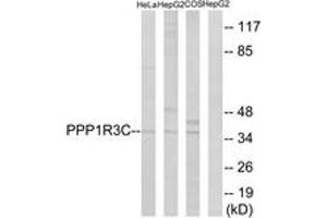 Western blot analysis of extracts from HepG2/HeLa/COS7 cells, using PPP1R3C Antibody. (PPP1R3C Antikörper  (AA 44-93))