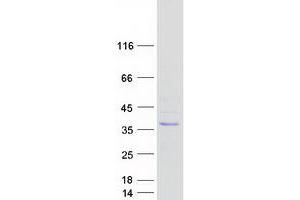 Validation with Western Blot (SUSD6/KIAA0247 Protein (Myc-DYKDDDDK Tag))