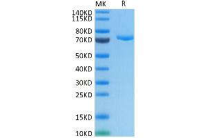 PVRL4 Protein (AA 32-349) (Fc Tag)