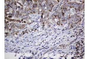 Image no. 5 for anti-NADH Dehydrogenase (Ubiquinone) 1 beta Subcomplex, 10, 22kDa (NDUFB10) antibody (ABIN1499672) (NDUFB10 Antikörper)