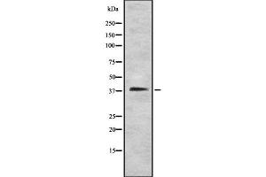 Western blot analysis STEAP1 using HT29 whole cell lysates (STEAP1 Antikörper  (N-Term))