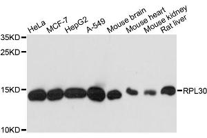 Western blot analysis of extracts of various cell lines, using RPL30 antibody. (RPL30 Antikörper)