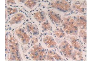 IHC-P analysis of Human Stomach Tissue, with DAB staining. (IL-4 Antikörper)
