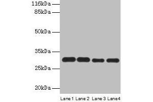 Western blot All lanes: PMM1 antibody at 2 μg/mL Lane 1: HepG2 whole cell lysate Lane 2: NIH/3T3 whole cell lysate Lane 3: 293T whole cell lysate Lane 4: Mouse brain tissue Secondary Goat polyclonal to rabbit IgG at 1/10000 dilution Predicted band size: 30 kDa Observed band size: 30 kDa (PMM1 Antikörper  (AA 2-262))