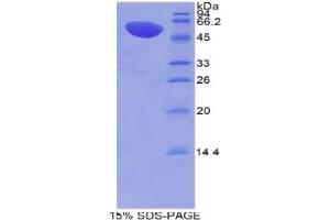 SDS-PAGE analysis of Mouse MX1 Protein. (MX1 Protein)