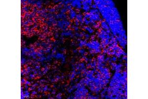 Immunofluorescence (Paraffin-embedded Sections) (IF (p)) image for anti-La Ribonucleoprotein Domain Family, Member 1 (LARP1) antibody (ABIN7074453)