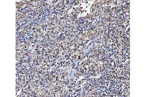 IHC analysis of ATP1B2 using anti-ATP1B2 antibody (ABIN7599221).