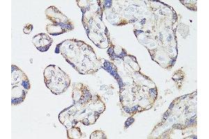 Immunohistochemistry of paraffin-embedded human placenta using MTOR antibody. (MTOR Antikörper  (AA 2388-2487))