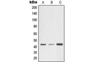 Western blot analysis of MMP3 expression in A549 (A), MCF7 (B), rat heart (C) whole cell lysates. (MMP3 Antikörper  (Center))