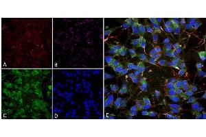 Immunocytochemistry (ICC) image for anti-Solute Carrier Family 17 (Vesicular Glutamate Transporter), Member 7 (SLC17A7) (AA 493-560) antibody (PE) (ABIN2483731)