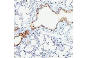 IHC analysis of TEK using anti-TEK antibody (ABIN7600762). (TEK Antikörper  (AA 23-616))