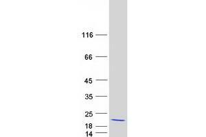Western Blotting (WB) image for Polymerase (DNA-Directed), delta 4, Accessory Subunit (POLD4) protein (Myc-DYKDDDDK Tag) (ABIN2729302)
