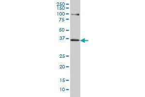 Western Blotting (WB) image for anti-Transcription Factor 19 (TCF19) (AA 17-103) antibody (ABIN598965) (TCF19 Antikörper  (AA 17-103))
