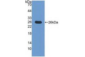 Detection of Recombinant ICOSLG, Mouse using Polyclonal Antibody to Inducible T-Cell Co Stimulator Ligand (ICOSLG) (ICOSLG Antikörper  (AA 58-249))