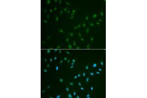 Immunofluorescence analysis of A549 cell using HSF2 antibody. (HSF2 Antikörper)