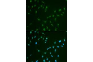 Immunofluorescence analysis of A549 cell using HSF2 antibody. (HSF2 Antikörper)