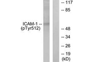 Western blot analysis of extracts from HeLa cells treated with TNF-alpha 20ng/ml 5', using ICAM-1 (Phospho-Tyr512) Antibody. (ICAM1 Antikörper  (pTyr512))