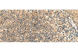 Immunohistochemistry of paraffin-embedded Human tonsil tissue using TCAP Polyclonal Antibody at dilution of 1:55(x200) (TCAP Antikörper)