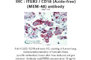 Image no. 1 for anti-Integrin beta 2 (ITGB2) antibody (ABIN1723416) (Integrin beta 2 Antikörper)