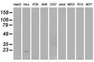 Image no. 2 for anti-Adenylate Kinase 1 (AK1) antibody (ABIN1496514) (Adenylate Kinase 1 Antikörper)