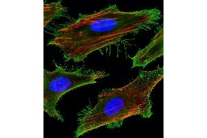 Fluorescent image of Hela cells stained with FA Antibody (Center) (ABIN1881332 and ABIN2843378). (FAM159A Antikörper  (AA 89-115))