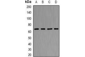 Western blot analysis of NUP62 expression in Hela (A), Jurkat (B), HT29 (C), Raji (D) whole cell lysates.