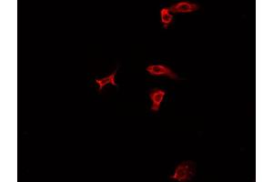 ABIN6277935 staining HepG2? (PRMT7 Antikörper  (Internal Region))