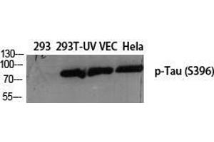 Western Blot (WB) analysis of specific cells using Phospho-Tau (S396) Polyclonal Antibody.
