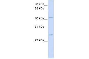 SLC37A4 antibody used at 1 ug/ml to detect target protein. (SLC37A4 Antikörper)