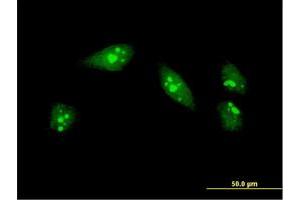 Immunofluorescence of monoclonal antibody to MEOX1 on HeLa cell. (MEOX1 Antikörper  (AA 165-252))