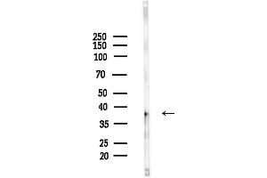 Western blot analysis of lysates from Mouse brain, using Phospho-Nucleophosmin (Ser125) Antibody at 1/1000 dilution.