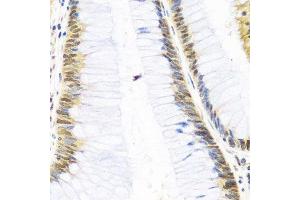 Immunohistochemistry (Paraffin-embedded Sections) (IHC (p)) image for anti-Superkiller Viralicidic Activity 2-Like 2 (SKIV2L2) (AA 1-304) antibody (ABIN6147814)