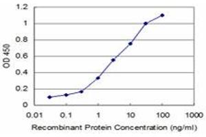 Detection limit for recombinant GST tagged RCV1 is approximately 0. (Recoverin Antikörper  (AA 101-199))