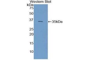 Western Blotting (WB) image for anti-Ficolin (Collagen/fibrinogen Domain Containing) 1 (FCN1) (AA 25-317) antibody (ABIN3207865) (FCN1 Antikörper  (AA 25-317))