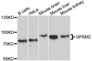 Western blot analysis of extracts of various cells, using GPSM2 antibody. (GPSM2 Antikörper)