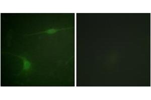 Immunofluorescence analysis of NIH-3T3 cells, using JIP1 (Phospho-Thr103) Antibody. (MAPK8IP1 Antikörper  (pThr103))