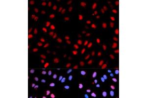 Immunofluorescence analysis of U2OS cells using Phospho-RAF1(S621) Polyclonal Antibody (RAF1 Antikörper  (pSer621))