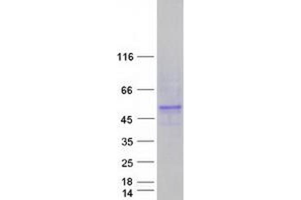 CYP4F22 Protein (Myc-DYKDDDDK Tag)