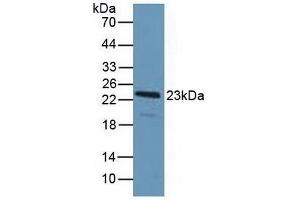 Detection of PDCD6 in Human Hela Cells using Polyclonal Antibody to Programmed Cell Death Protein 6 (PDCD6)