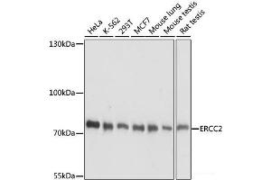 Western blot analysis of extracts of various cell lines using ERCC2 Polyclonal Antibody at dilution of 1:1000. (ERCC2 Antikörper)