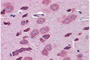 Mouse Brain: Formalin-Fixed, Paraffin-Embedded (FFPE) (TBR1 Antikörper  (AA 51-100))