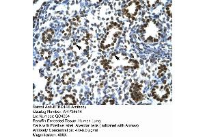 Human Lung (NAC1 Antikörper  (Middle Region))